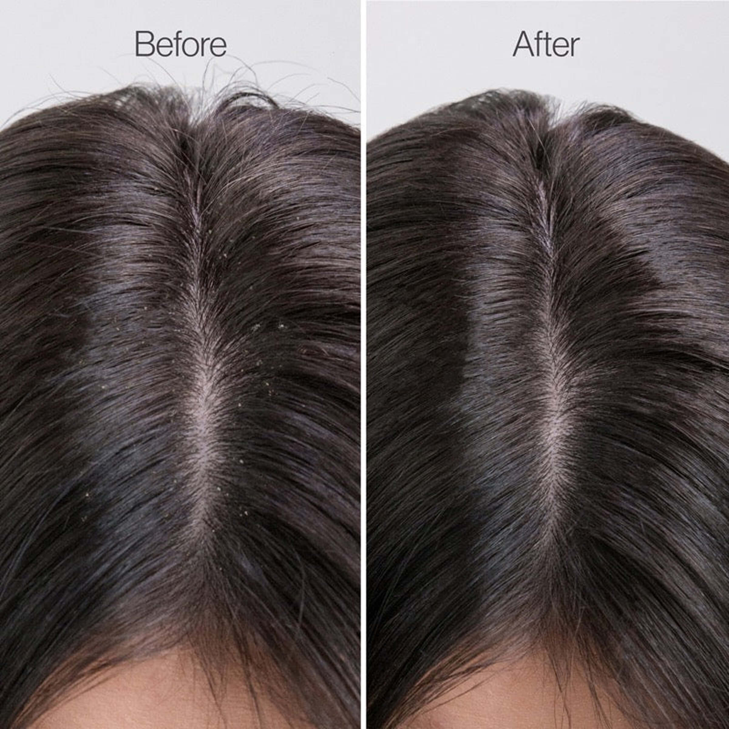 # 1 Hair Detox ToolKit