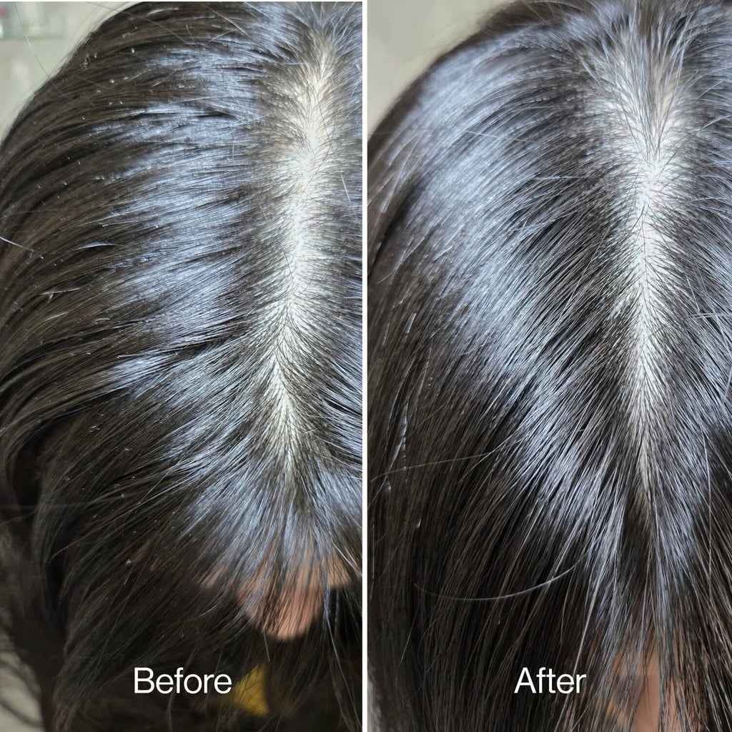 Gentle Exfoliating Scalp Scrub