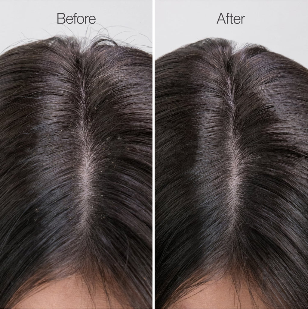 Scalp Therapy & Rebalance Routine