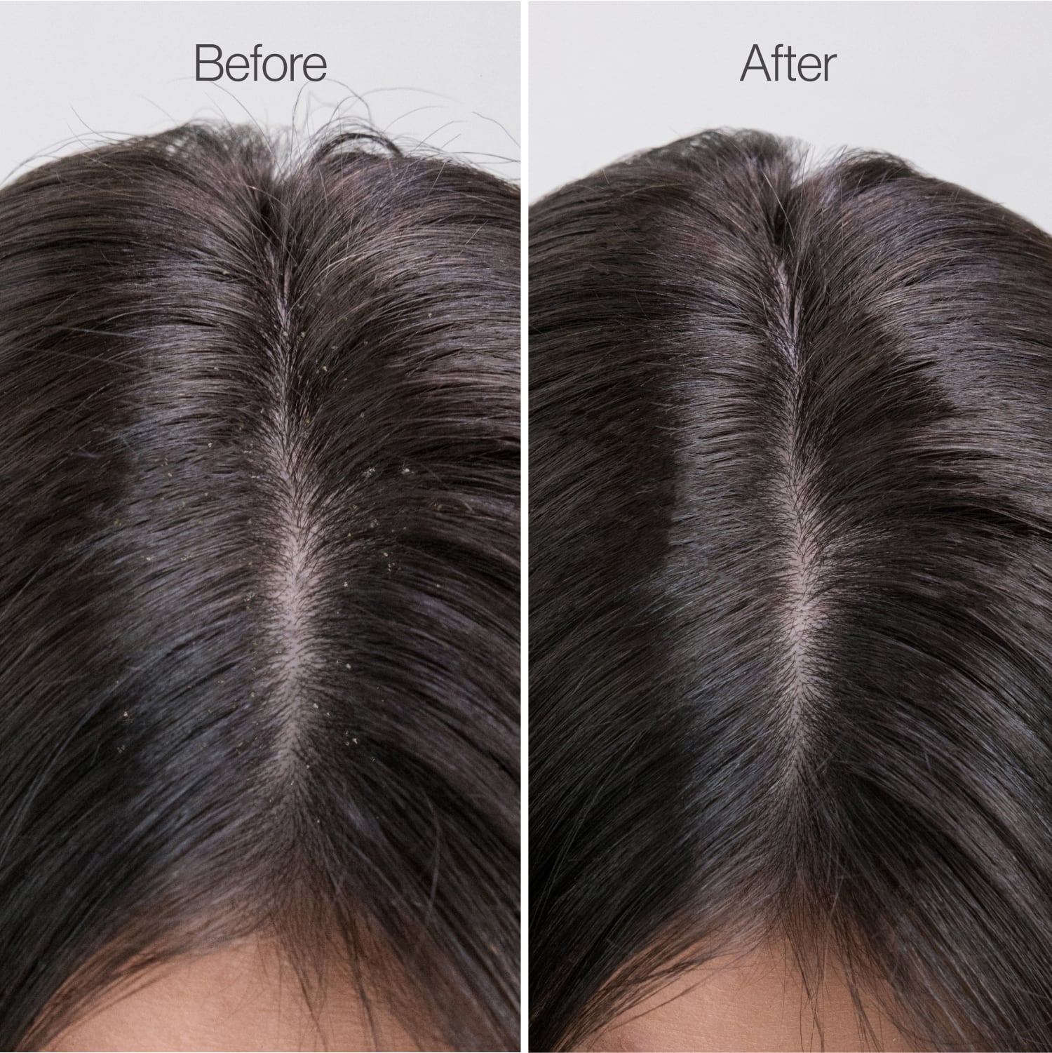 Scalp Therapy & Rebalance Routine