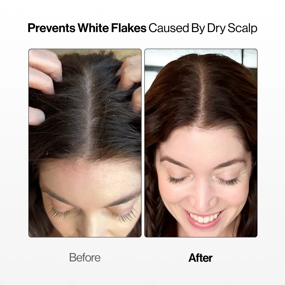 Soothing Scalp Serum (BOGO SPECIAL)