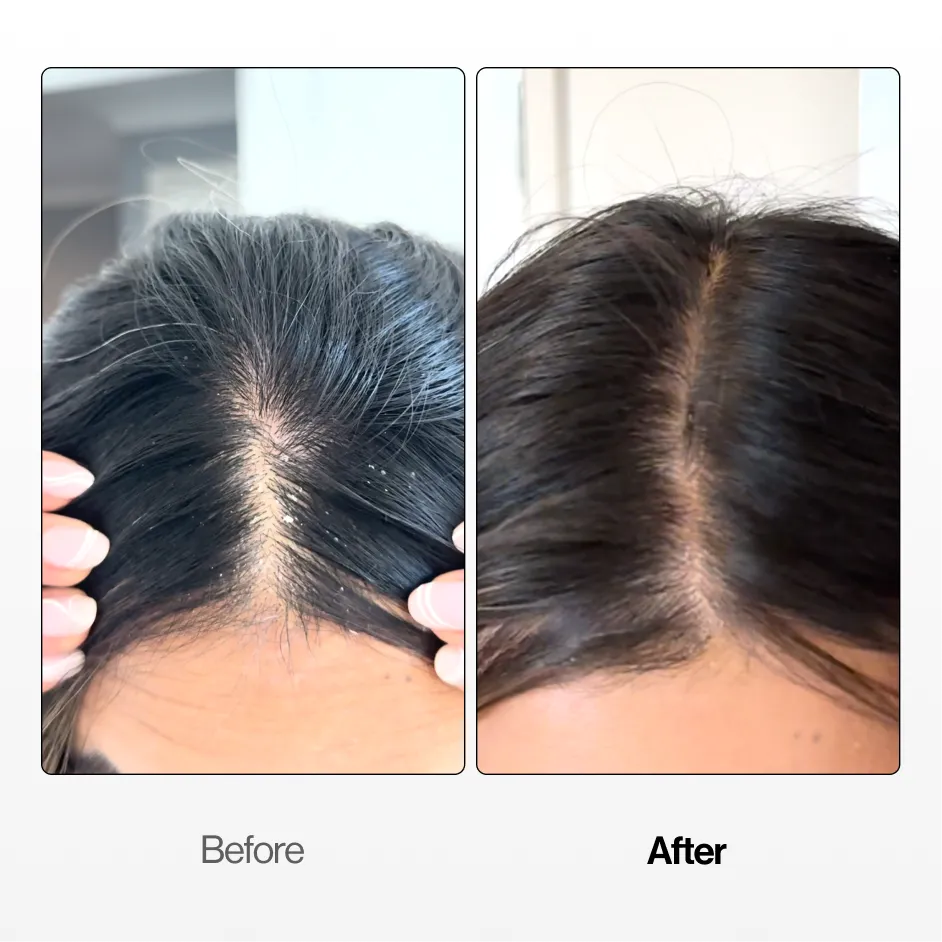 Soothing Scalp Serum (BOGO SPECIAL)