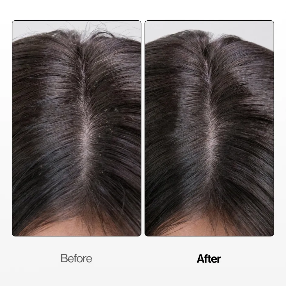 Soothing Scalp Serum (BOGO SPECIAL)