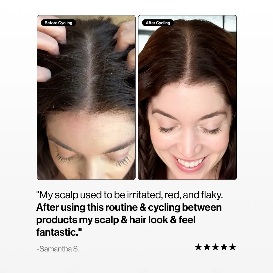 Before and after comparison of a woman's scalp health and hair condition.